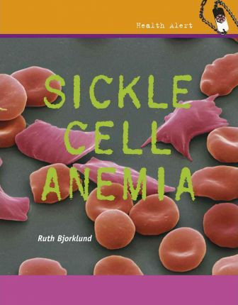 Sickle Cell Anemia - 9780761448211 by Ruth Bjorklund, 9780761448211