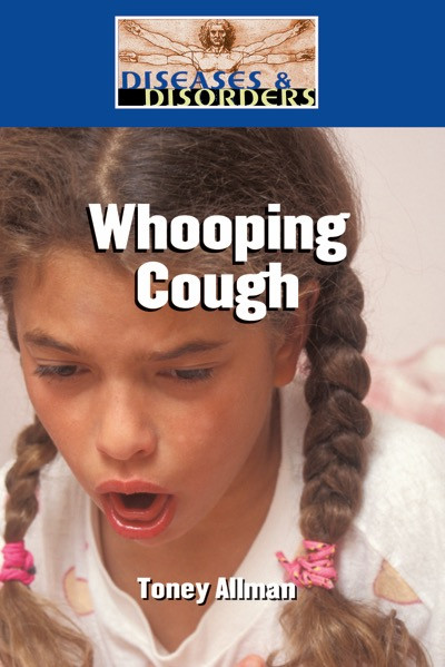 Whooping Cough by Toney Allman, 9781420507362