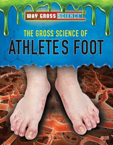 The Gross Science of Athlete's Foot by Mary-Lane Kamberg, 9781508181590