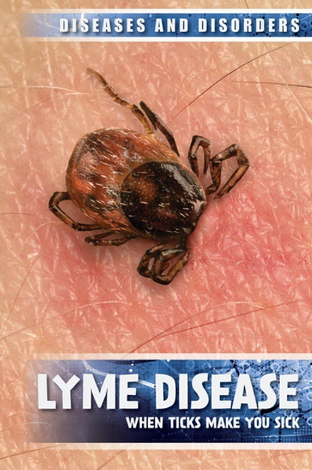 Lyme Disease (When Ticks Make You Sick) - 9781534563643 by Raymond J. Lampke, 9781534563643
