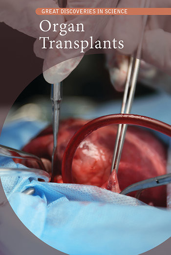 Organ Transplants - 9781502643919 by Cathleen Small, 9781502643919