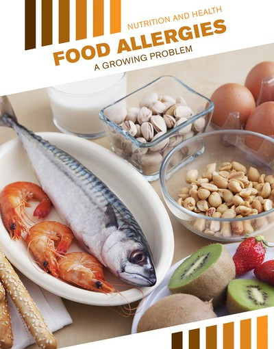 Food Allergies (A Growing Problem) by Jason Brainard, 9781534568709