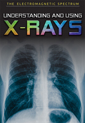 Understanding and Using X-Rays - 9781978515017 by Elizabeth Rubio, 9781978515017