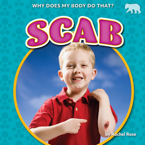 Scab - 9798885094603 by Rachel Rose, 9798885094603
