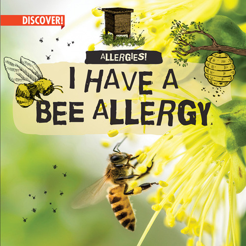 I Have a Bee Allergy by Kathleen Connors, 9781978533745