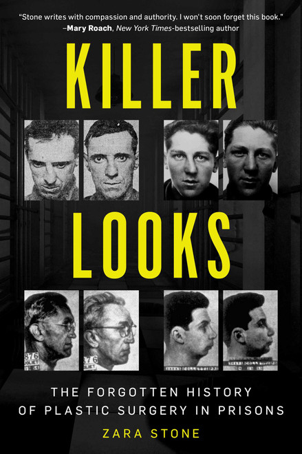 Killer Looks (The Forgotten History of Plastic Surgery in Prisons) by Zara Stone, 9781633886728