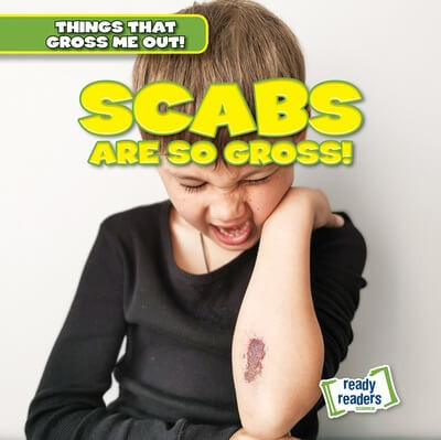 Scabs Are So Gross! - 9781482471458 by Lynda Arnez, 9781482471458