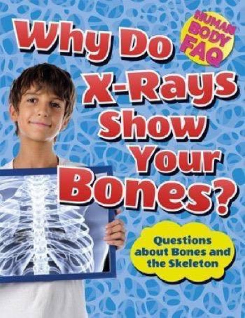 Why Do X-Rays Show Your Bones? (Questions About Bones and the Skeleton) by Thomas Canavan, 9781499431735