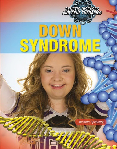 Down Syndrome by Richard Spilsbury, 9781508182818