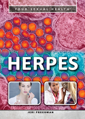 Herpes by Jeri Freedman, 9781499460551