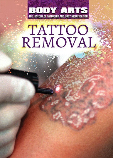 Tattoo Removal by Nicholas Faulkner, Frank Spalding, 9781508180807