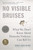 No Visible Bruises (What We Don't Know About Domestic Violence Can Kill Us) - 9781635570984 by Rachel Louise Snyder, 9781635570984