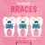 Wearing Braces by Harriet Brundle, 9781534529434