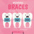 Wearing Braces - 9781534529458 by Harriet Brundle