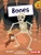 Bones - 9798765610381 by Jill Atkins, Gareth Robinson, 9798765610381