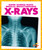 X-Rays - 9781645278054 by Alicia Z. Klepeis, 9781645278054
