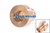 Casquillo guía RAVO Serie 5 vástago pistón eje delantero (60056435)