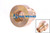 Casquillo guía RAVO Serie 5 vástago pistón eje delantero (60056435)
