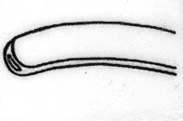 16-3920 - RANDOLPH CYCLODIALYSIS CANNULA ANGLE SPATULATED TIP 19GA