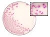 Top-down view of an agar petri dish showing isolated purple-pink bacterial colonies.