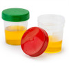 Specimen Container, 4oz, with Full Turn Red Separate Screwcap, Frosted Writing Area, Non-Sterile, PP, Graduated, 500/cs
