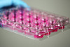 Gloved hands holding a transparent 12-well cell culture plate filled with pink liquid.