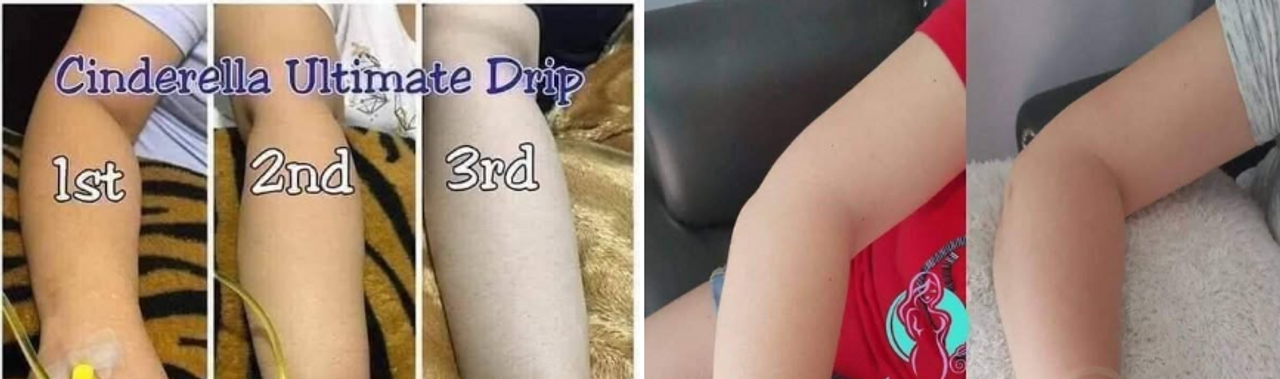 CINDYRELLA - Ultimate Celestial Drip (Skin Bleaching)