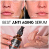 InstaSkincare Renewing and Moisturizing Bundle  Hyaluronic Acid Serum for Face 2Oz  Retinol Face Serum 2Oz