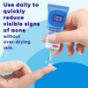 CLEAN & CLEAR ADVANTAGE Acne Spot Treatment Oil-Free 0.75 oz