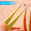 Ingrown Hair / Splinter Tweezer
1 piece