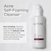Acne Selffoaming Cleanser 180 Ml / 6.1 Fl Oz