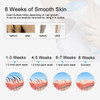 Permanent IPL Laser Hair Removal System for Women & Men,IPL Hair Removal Device 300000 Flashes Professional Light Laser Hair Removal at Home Use,Facial Hair Removal for Women.