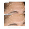 StriVectin Advanced Retinol Serums & Moisturizers for Fines Lines & Wrinkles, Improves Skin Elasticity for Firmer Skin