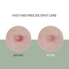 SCINIC Cica Blemish Clear Spot Patch 4mg  9patch  Fast Care For Spot Areas Of Concern  Spot Patch For The Intensive Care Of Local Areas  Korean Makeup