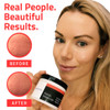 Yeouth Retinol Face Moisturizer with Hyaluronic Acid Moisturizing Face Cream for Wrinkle  Dark Spot Night Cream Face Care Anti Aging Skin Care