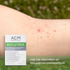Laboratoire ACM Molutrex 5% Potassium Hydroxide 3ml