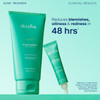 Skinfix Acne+ 2% BHA + Azelaic Acid + Niacinamide + AHA Cleanser 148 ml