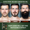 Beard Growth Oil with Biotin & Caffeine -Naturally Beard Growth Serum Promote Hair Regrowth,Full, Thick, Masculine Facial Hair Treatment for Men 30ml