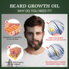 Beard Growth Oil with Biotin & Caffeine -Naturally Beard Growth Serum Promote Hair Regrowth,Full, Thick, Masculine Facial Hair Treatment for Men 30ml