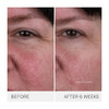 Augustinus Bader Mini The Rich Cream with TFC8® Face Moisturizer