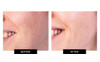 TriPollar STOP X + TriPollar STOP Preparation Gel Value Bundle - DM Edition
