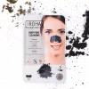 Iroha Nature DETOX CHARCOAL BLACK nose strips Acne Treatment Cream & blackhead removal