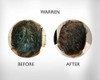 Regrowz Hair Regrowth Thickening Treatment Six Month Program For Men