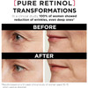 L'Oreal Paris Revitalift Triple Power Lzr Retinol Night Serum For Face With 0.3% Pure Retinol Moisturizes Skin And Eliminates Deep Wrinkles For All Skin Types 30Ml