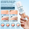 Advanced Scar Cream, Silicone Scar Gel, Treats Old And Scars, Reduces The Appearance Of Scars From, Body, Face, Stretch Marks, Surgical Scar, Keloids, Acne, Burns And More, 1.7 Oz