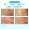 Scar Gel Advanced Scar Treatment, Silicone Scar Gel Scar Removal Scar Cream Gel Silicone Gel Scar Gel For Face C-Section Tummy Tuck Keloid And Surgical Scars Burns Old Scars Deep Acne Scar Removal