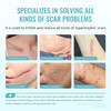 Scar Gel Advanced Scar Treatment, Silicone Scar Gel Scar Removal Scar Cream Gel Silicone Gel Scar Gel For Face C-Section Tummy Tuck Keloid And Surgical Scars Burns Old Scars Deep Acne Scar Removal