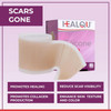 Medical Grade Silicone Scar Sheets - Non-Irritating Scar Strips For Surgical Scars, C-Section, Tummy Tuck, And Keloid - Premium Soft Gel Strips For Pain-Scar Removal (1.6In X 120In)