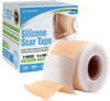 Silicone Scar Tape,Silicone Scar Sheet (1.6” X 60” Roll, 1.5M) Scar Removal Strips For Surgical Scars,Keloids, C-Section, & Burns Tummy Tuck– Effective Scar Treatment For Faster Healing Reusable Tape