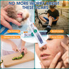 Scarmd Medical Grade Silicone Scar Gel Treatment,Keloid Bump Removal,Fades Scars From Surgery, Burn Scar,Face Belly Piercings, C Section, Cuts,Scratch,Scars Removal Treatment,Reduces Discomfort, 6G Scarmd Medical Grade Silicone Scar Gel Treatment,Keloid Bump Removal,Fades Scars From Surgery, Burn Scar,Face Belly Piercings, C Section, Cuts,Scratch,Scars Removal Treatment,Reduces Discomfort, 6G